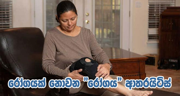 රෝගයක් නොවන “රෝගය” ආතරයිටිස්